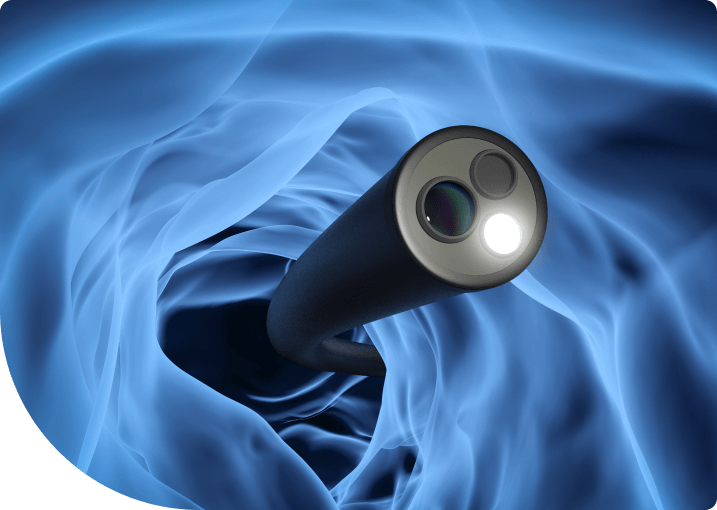 what-is-an-endoscopy 1